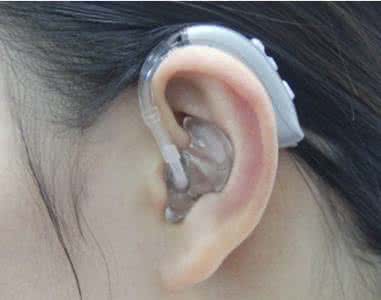 耳背式助听器有哪些有点[能用多久]