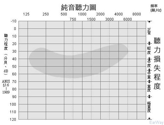 纯音测试图怎么看