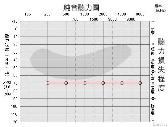 纯音测试图怎么看