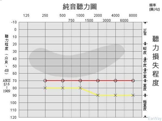 纯音测试图怎么看