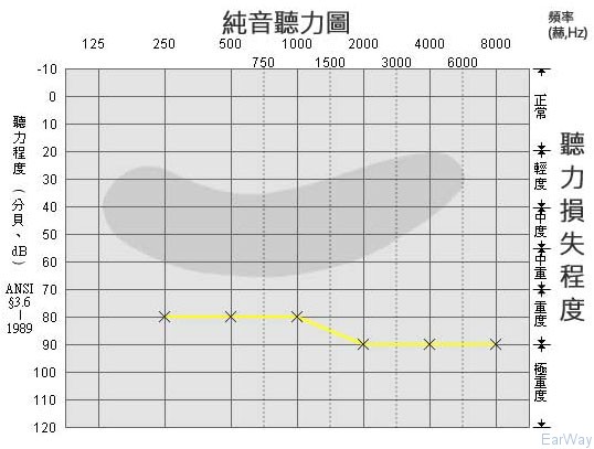 纯音测试图怎么看