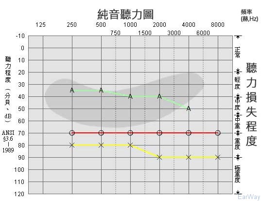 纯音测试图怎么看