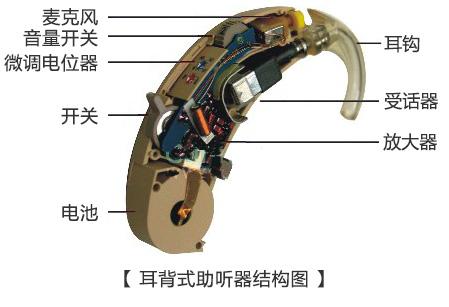 助听器通气孔-什么是助听器通气孔