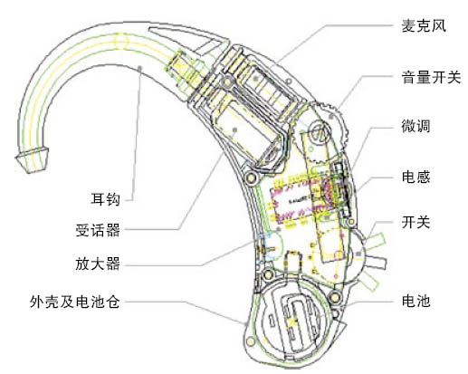 耳聋患者佩戴助听器的真实感受[案例精选]