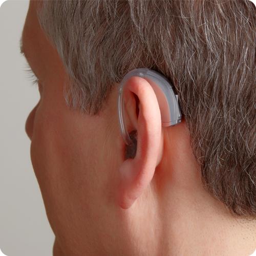 助听器耳鸣-助听器对耳鸣有帮助吗