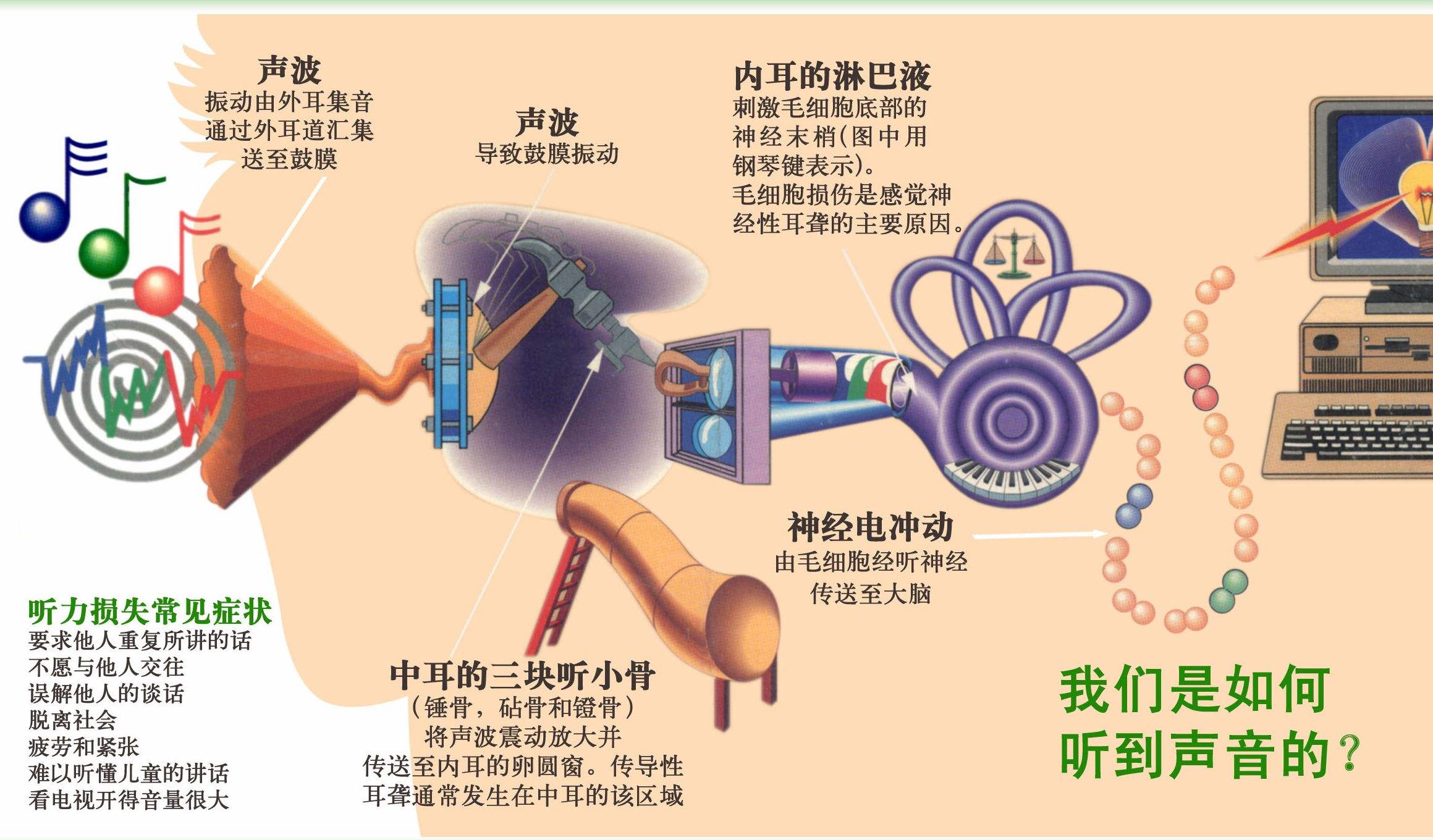 助听器工作原理？助听器如何工作的